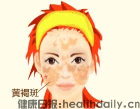 有了黄褐斑不用慌,中医中药来帮忙。(图1) 有了黄褐斑不用慌,中医中药来帮忙。(图1)