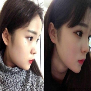 学会这4个瘦脸方法让你也能拥有瓜子脸